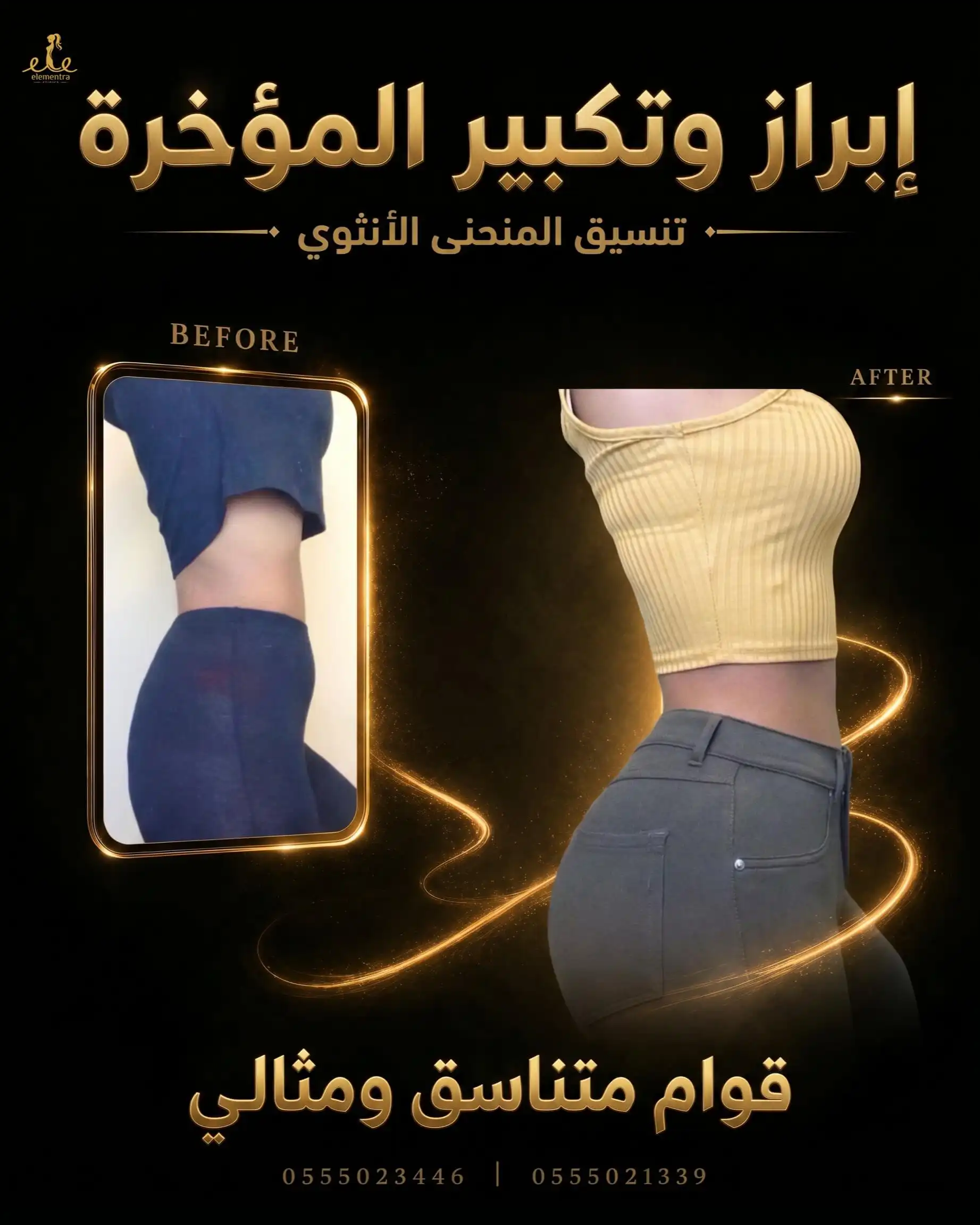 إبراز وتكبير المؤخرة